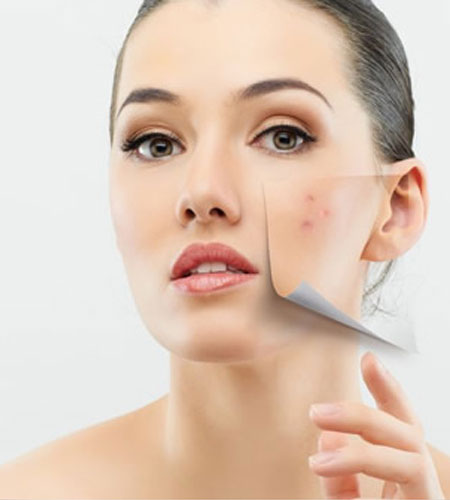 DERMABRAZYON